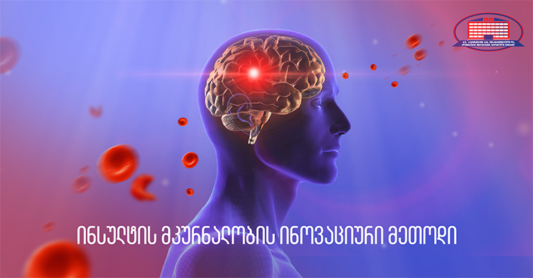 პირველად საქართველოში და მხოლოდ ქირურგიის ეროვნულ ცენტრში! სისტემური თრომბოლიზისისა და თრომბექტომიის კომბინაციით ინსულტის მქონე პაციენტი სიკვდილს გადაურჩა